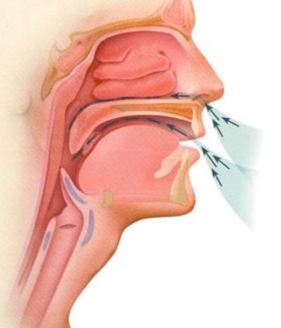 Adolescent Obstructive Sleep Apnea