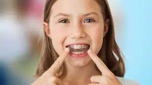 Best Invisalign Teen Provider In Southpark