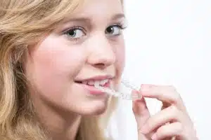 Invisalign For Teens In Southpark