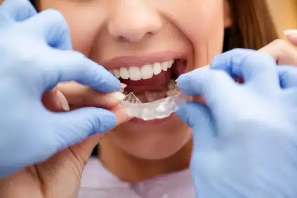 Invisalign In Ballantyne, Nc | Get A Confident Smile 2 Orthodontist Fitting Invisalign Aligner In Ballantyne Nc Office