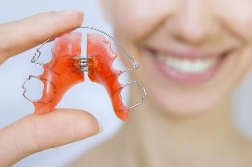 Palatal Expander Types