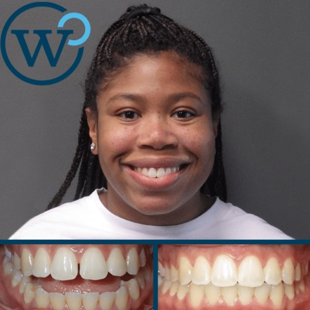 Before-And-After-Treratment-Matthews-Nc