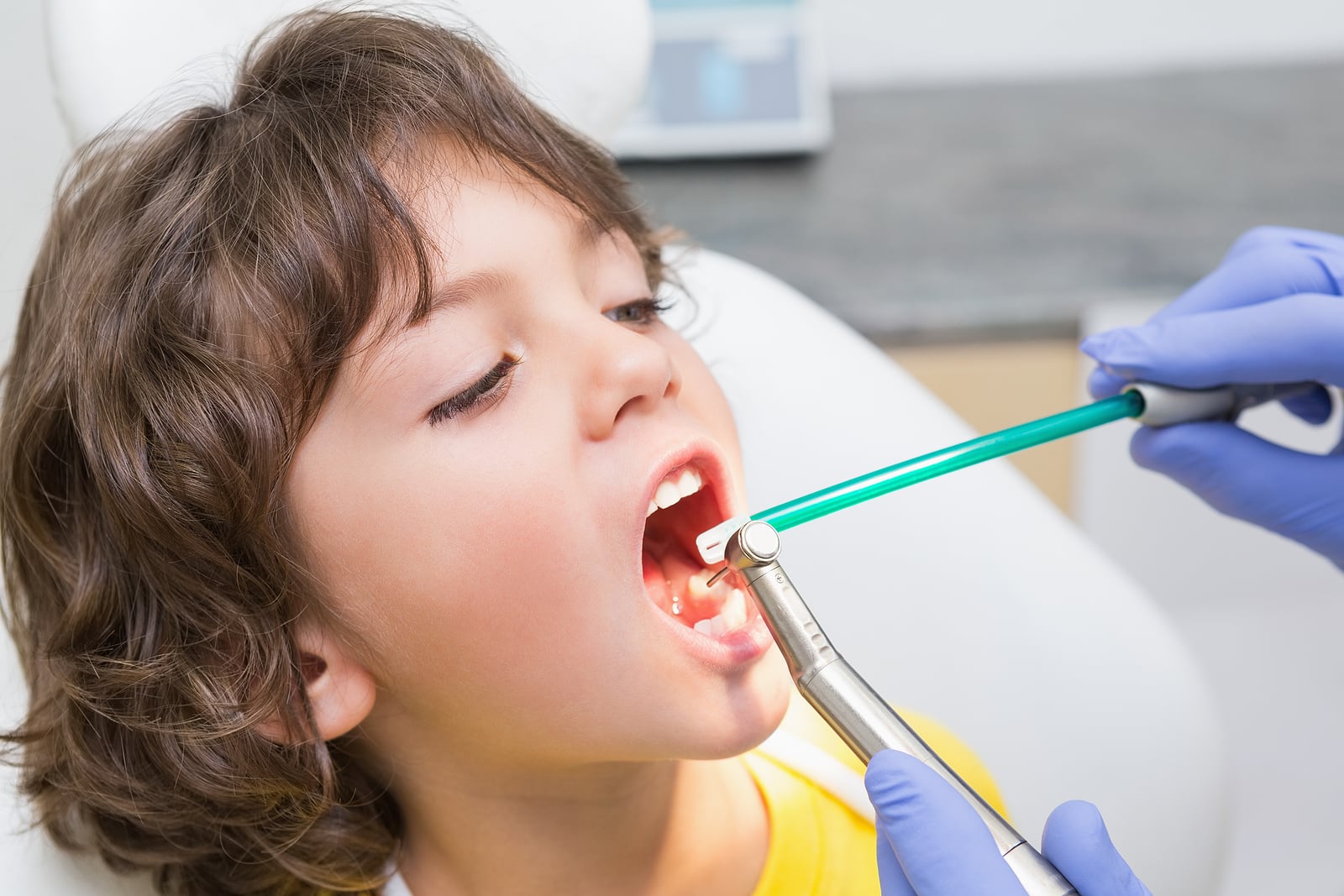 Orthodontist-Near-Matthews-Nc-Consultation